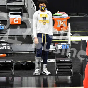 isaiah livers broken foot